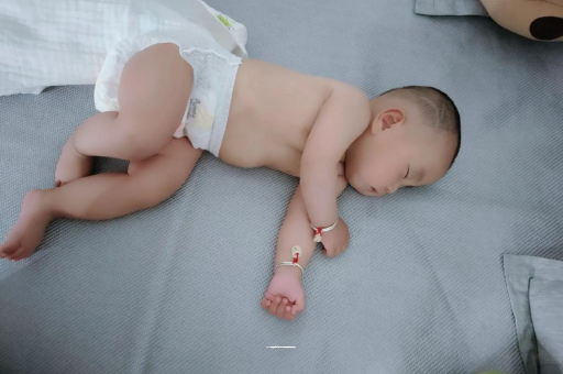 宜宾六个月宝宝眼睛散光